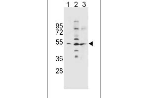 SLC36A1 Antibody (N-term) (ABIN656104 and ABIN2845446) western blot analysis in NCI-(lane 1),K562(lane 2),A549(lane 3) cell line lysates (35 μg/lane). (SLC36A1 antibody  (N-Term))