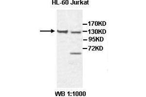 Western blot analysis of HL-60 and Jurkat cell lysate, using CHL1 antibody. (CHL1 antibody  (AA 788-1025))