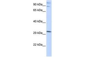 Image no. 1 for anti-Zinc Finger Protein 148 (ZNF148) (AA 684-733) antibody (ABIN6742483) (ZNF148 antibody  (AA 684-733))