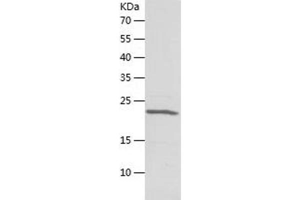 CBX5 Protein (AA 1-191) (His tag)