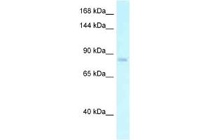 WB Suggested Anti-EMR2 Antibody Titration: 1. (EMR2 antibody  (N-Term))