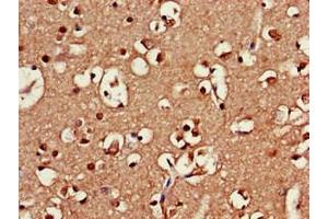 Immunohistochemistry of paraffin-embedded human brain tissue using ABIN7168941 at dilution of 1:100 (SRR antibody  (AA 1-340))
