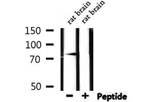 Western Blotting (WB) image for anti-Sodium Channel, Nonvoltage-Gated 1, beta (SCNN1B) (C-Term) antibody (ABIN6264946)