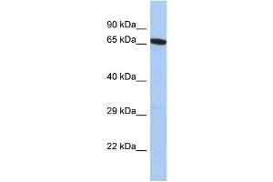 Host: Rabbit Target Name: GALNT15 Sample Type: PANC1 Whole Cell lysates Antibody Dilution: 1. (GALNT14 antibody  (N-Term))
