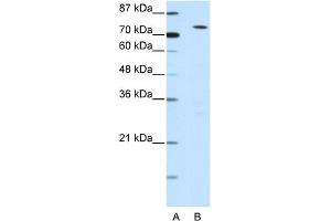 WB Suggested Anti-MYST2 Antibody Titration:  0. (MYST2 antibody  (N-Term))