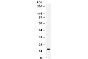 Western blot testing of human MCF7 cell lysate with GIP antibody.