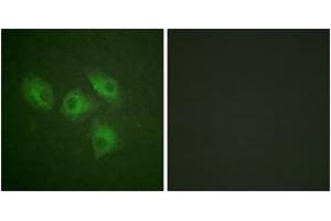 Immunofluorescence analysis of HeLa cells, using PI3-kinase p85-alpha (Ab-607) Antibody. (PIK3R1 antibody  (AA 573-622))