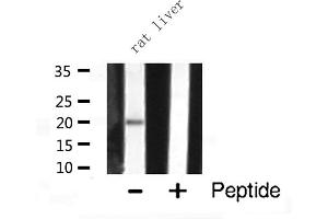 Western blot analysis of JM4 expression in Rat liver lysate (PRAF2 antibody  (C-Term))