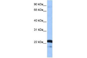 SFRS9 antibody used at 1 ug/ml to detect target protein. (SFRS9 antibody  (Middle Region))