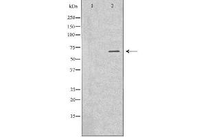 Western blot analysis of Hepg2 whole cell lysates, using AFP Antibody. (alpha Fetoprotein antibody  (C-Term))