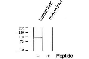 TCTN2 antibody  (Internal Region)