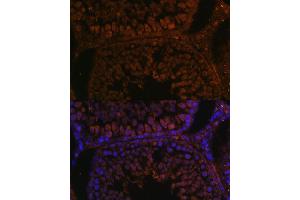 Immunofluorescence analysis of rat testis using TPD52L3 antibody (ABIN7271078) at dilution of 1:100. (TPD52L3 antibody  (AA 1-132))