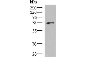 Western blot analysis of PC3 cell lysate using GSPT2 Polyclonal Antibody at dilution of 1:600 (GSPT2 antibody)