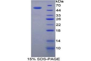 SDS-PAGE (SDS) image for Transglutaminase 1, Keratinocyte (TGM1) (AA 504-737) protein (His tag,GST tag) (ABIN2123709)