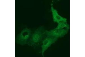 Anti-BEST3 mouse monoclonal antibody (ABIN2452805) immunofluorescent staining of COS7 cells transiently transfected by pCMV6-ENTRY BEST3 (RC218436). (Bestrophin 3 antibody)