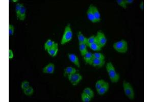 Immunofluorescence staining of HepG2 cells with ABIN7147549 at 1:100, counter-stained with DAPI. (CMKLR1 antibody  (AA 321-373))