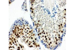 IHC-P: MCAK antibody testing of mouse testis tissue (KIF2C antibody  (AA 531-725))
