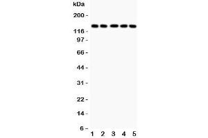Western blot testing of Collagen Type 2 antibody and Lane 1:  COLO320;  2: HeLa;  3: MCF-7;  4: A549;  5: Jurkat lysate. (COL2A1 antibody  (C-Term))