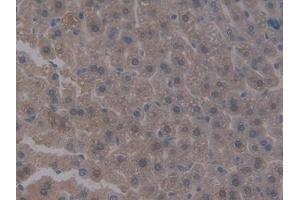 #VALUE! (Integrin beta 5 antibody  (AA 136-378))