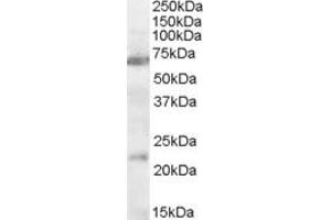 ABIN334375 (0. (CHRNA4 antibody  (AA 29-43))