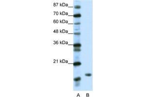 Western Blotting (WB) image for anti-TATA-Binding Protein-Associated Phosphoprotein (DR1) antibody (ABIN2461641) (DR1 antibody)
