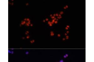 Immunofluorescence (IF) image for anti-SMAD, Mothers Against DPP Homolog 2 (SMAD2) (pSer423), (pSer425), (pSer465), (pSer467) antibody (ABIN7265256)