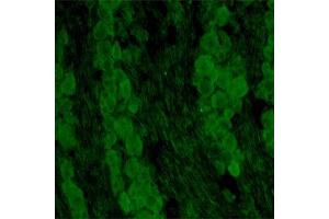 IF on rat DRG (postnatal day 7) at 40 µg/ml concentration using Sheep antibody to extracellular domain of TrkC (Trk-C, NTRK3, NT-3 growth factor receptor): IgG(ABIN351085). (NTRK3 antibody  (Extracellular Domain))