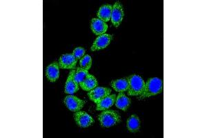 Confocal immunofluorescent analysis of CD46 Antibody (C-term) (ABIN650982 and ABIN2840022) with Hela cell followed by Alexa Fluor® 489-conjugated goat anti-rabbit lgG (green). (CD46 antibody  (C-Term))