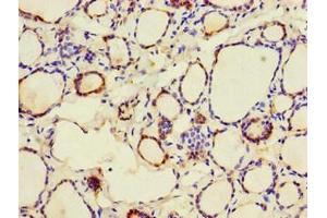 Immunohistochemistry of paraffin-embedded human thyroid tissue using ABIN7146571 at dilution of 1:100 (Calreticulin antibody  (AA 18-417))