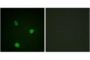 Immunofluorescence (IF) image for anti-Microphthalmia-Associated Transcription Factor (MITF) (AA 151-200) antibody (ABIN2888676) (MITF antibody  (AA 151-200))