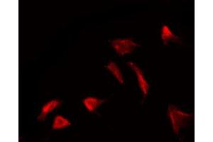 Immunofluorescence (fixed cells) (IF/ICC) image for anti-Adrenergic, beta-2-, Receptor, Surface (ADRB2) (pSer346) antibody (ABIN6256279)
