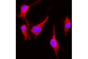 IF analysis of VEGF Receptor 2 using anti-VEGF Receptor 2 antibody (ABIN5693262).