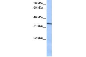 WB Suggested Anti-SEPT9(septin 9) Antibody Titration: 0. (Septin 9 antibody  (C-Term))