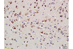 Formalin-fixed and paraffin embedded mouse brain labeled with Anti-SLC4A4 Polyclonal Antibody, Unconjugated (ABIN677498) at 1:400 followed by conjugation to the secondary antibody and DAB staining