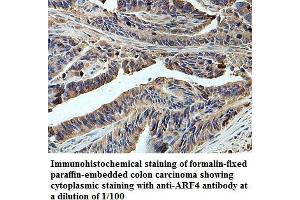 Image no. 1 for anti-ADP-Ribosylation Factor 4 (ARF4) antibody (ABIN1574782)
