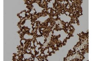 ABIN6276542 at 1/100 staining Mouse lung tissue by IHC-P. (RAC2 antibody  (C-Term))