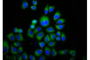 Immunofluorescence staining of Hela cells with ABIN7172863 at 1:133, counter-stained with DAPI. (TRPM3 antibody  (AA 1606-1713))