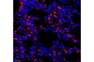 Immunofluorescence of paraffin embedded mouse lung using AMIGO2 (ABIN7072966) at dilution of 1: 1300 (400x lens) (AMIGO2 antibody)
