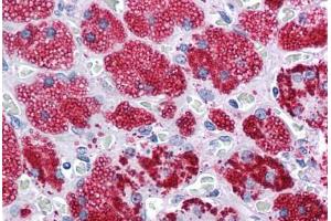 Human Adrenal: Formalin-Fixed, Paraffin-Embedded (FFPE) (ADRP antibody  (AA 28-281))