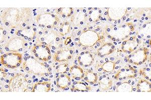 Detection of LAMP1 in Human Kidney Tissue using Polyclonal Antibody to Lysosomal Associated Membrane Protein 1 (LAMP1) (LAMP1 antibody  (AA 49-297))