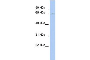 WB Suggested Anti-CCDC63 Antibody Titration: 0. (CCDC63 antibody  (Middle Region))