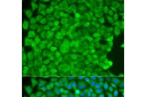 Immunofluorescence analysis of HeLa cells using SGCE Polyclonal Antibody