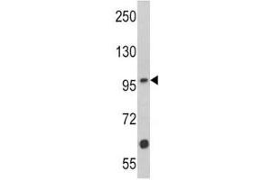 Western Blotting (WB) image for anti-Muscle, Skeletal, Receptor Tyrosine Kinase (MUSK) (AA 35-65) antibody (ABIN3031877)