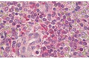 Anti-IL2RB / CD122 antibody IHC staining of human spleen, periarterial lymphocytes. (IL2 Receptor beta antibody  (AA 331-380))