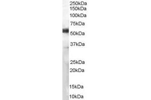 Western Blotting (WB) image for anti-Chromosome 13 Open Reading Frame 35 (C13ORF35) (C-Term) antibody (ABIN2791438) (C13orf35 antibody  (C-Term))