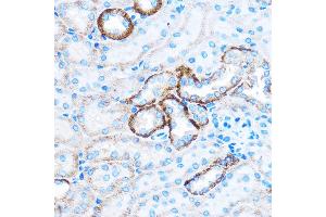 Immunohistochemistry of paraffin-embedded Mouse kidney using C Rabbit pAb (ABIN7266006) at dilution of 1:50 (40x lens). (CABP1 antibody)