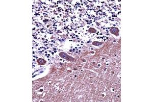 A1 Antibody (C-term) ((ABIN657826 and ABIN2846793))immunohistochemistry analysis in formalin fixed and paraffin embedded human cerebellum tissue followed by peroxidase conjugation of the secondary antibody and DAB staining. (alpha Adaptin antibody  (C-Term))