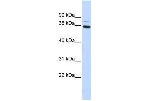 WB Suggested Anti-ZNF74 Antibody Titration:  0. (ZNF74 antibody  (Middle Region))