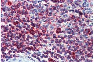 Human Spleen (formalin-fixed, paraffin-embedded) stained with HSPD1 antibody ABIN462364 followed by biotinylated anti-mouse IgG secondary antibody ABIN481714, alkaline phosphatase-streptavidin and chromogen. (HSPD1 antibody)