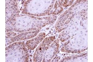 IHC-P Image Immunohistochemical analysis of paraffin-embedded Cal27 xenograft, using HS1BP3, antibody at 1:500 dilution. (HS1BP3 antibody  (C-Term))